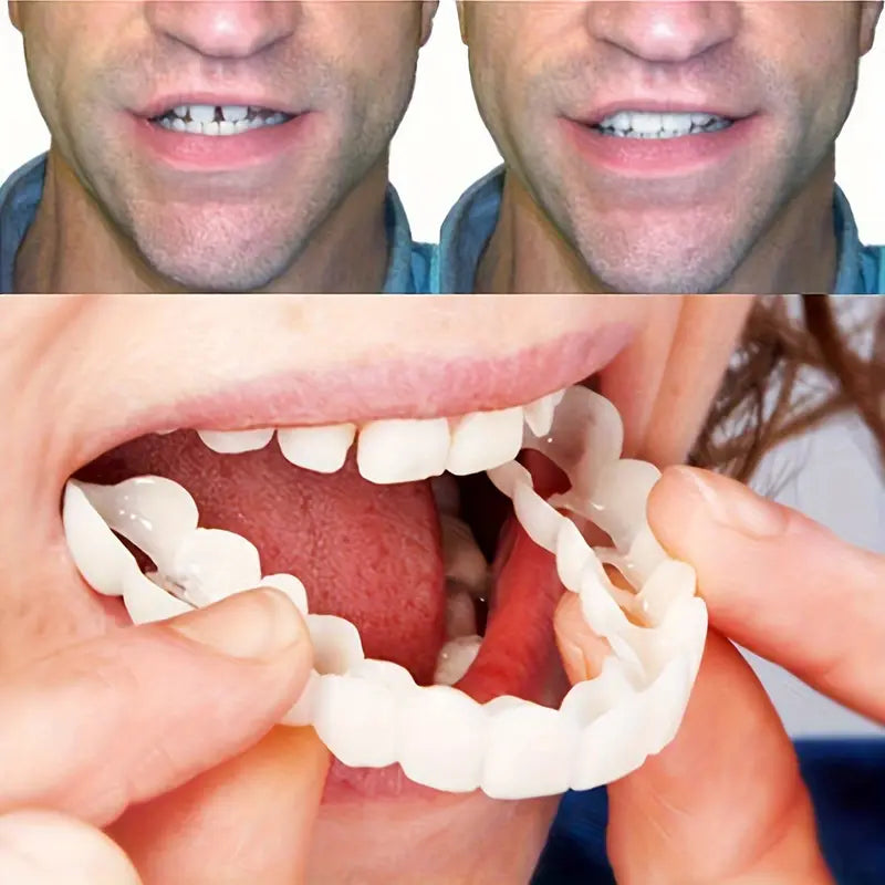 CARILLAS DENTALES