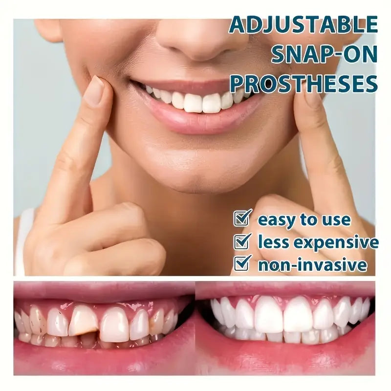 CARILLAS DENTALES
