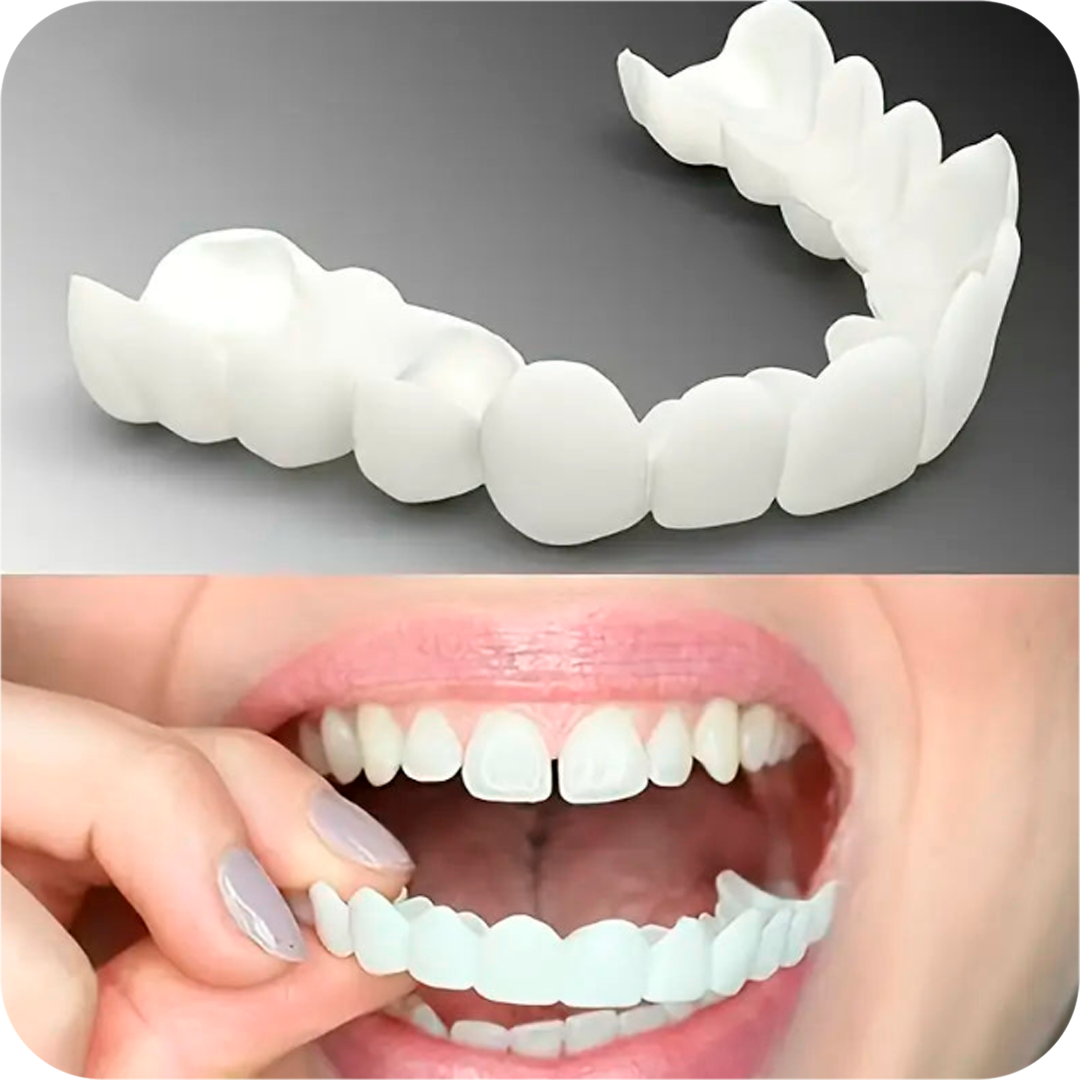 CARILLAS DENTALES